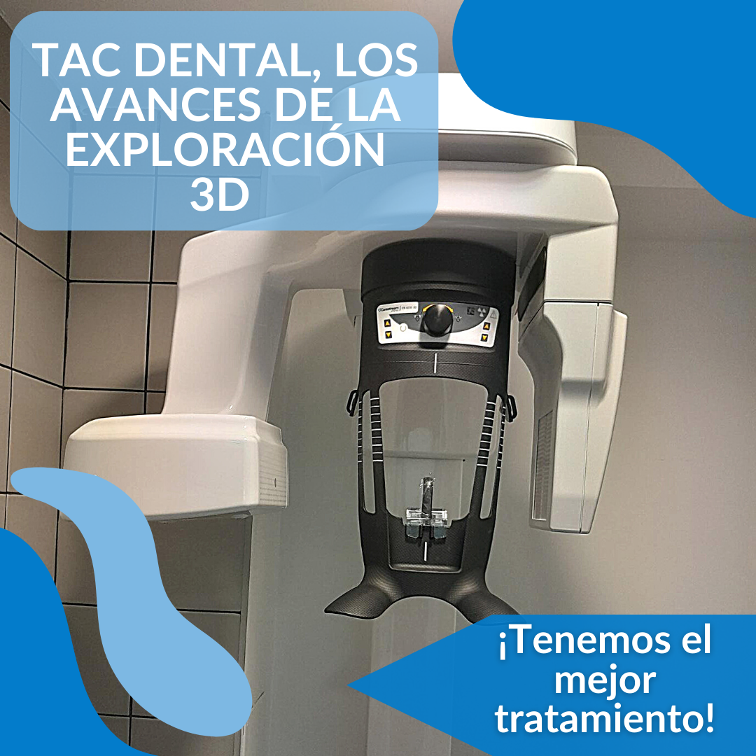 tac-dental-avances-exploración-3d