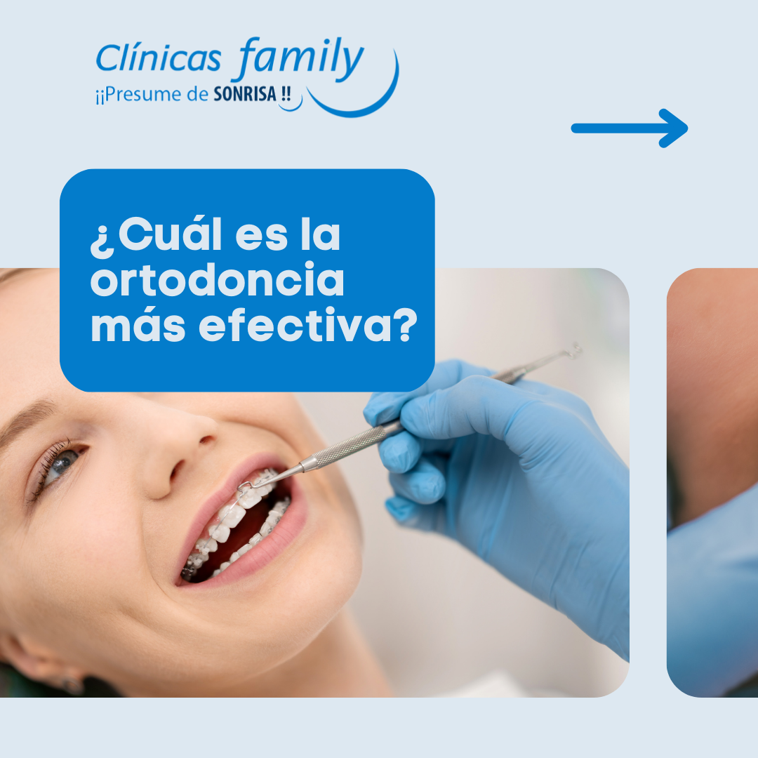 ortodoncia-mas-efectiva