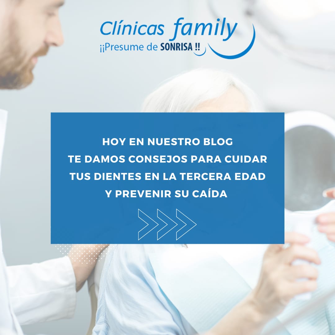 Consejos para cuidar los dientes en la tercera edad y prevenir su caída.