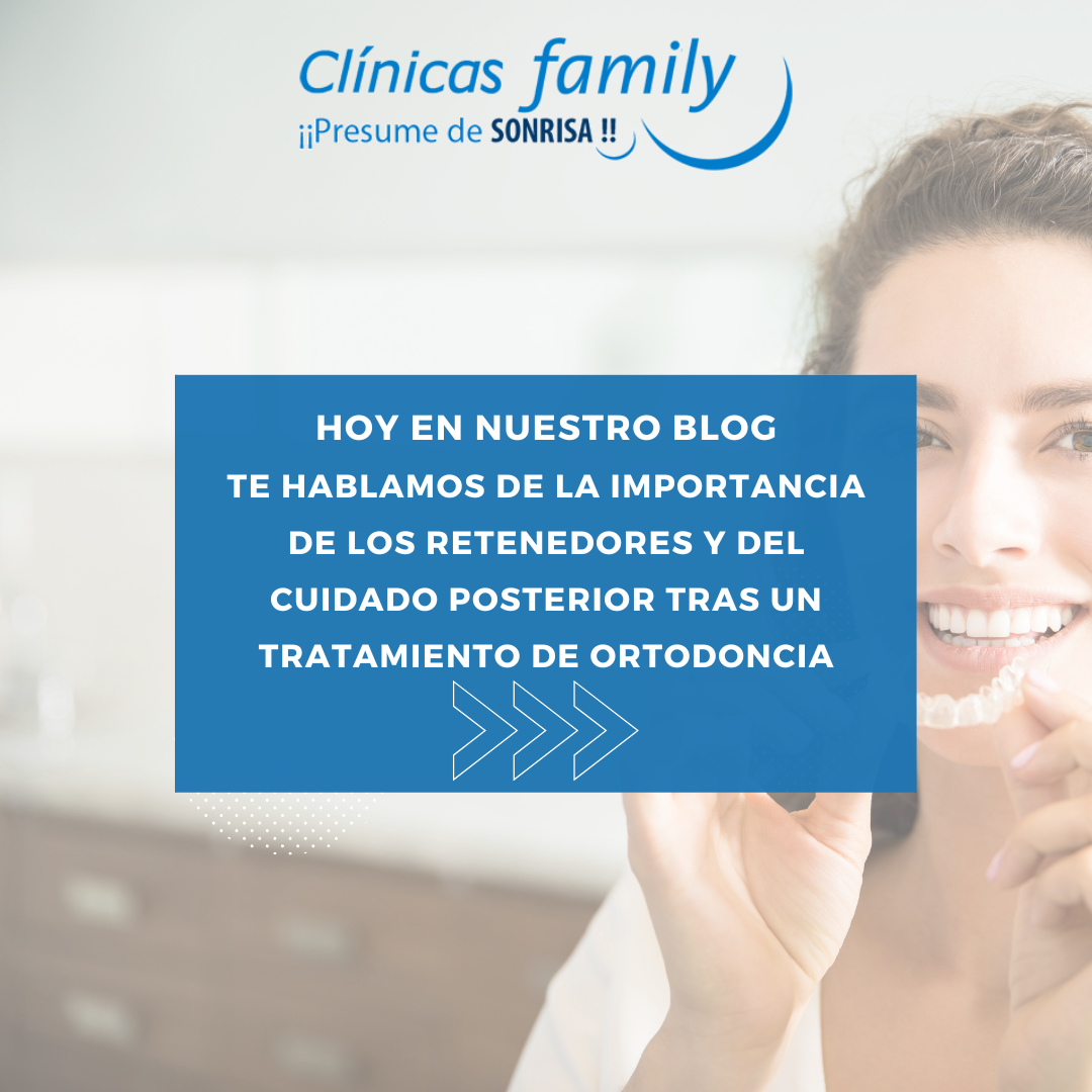 la-importancia-de-los-retenedores