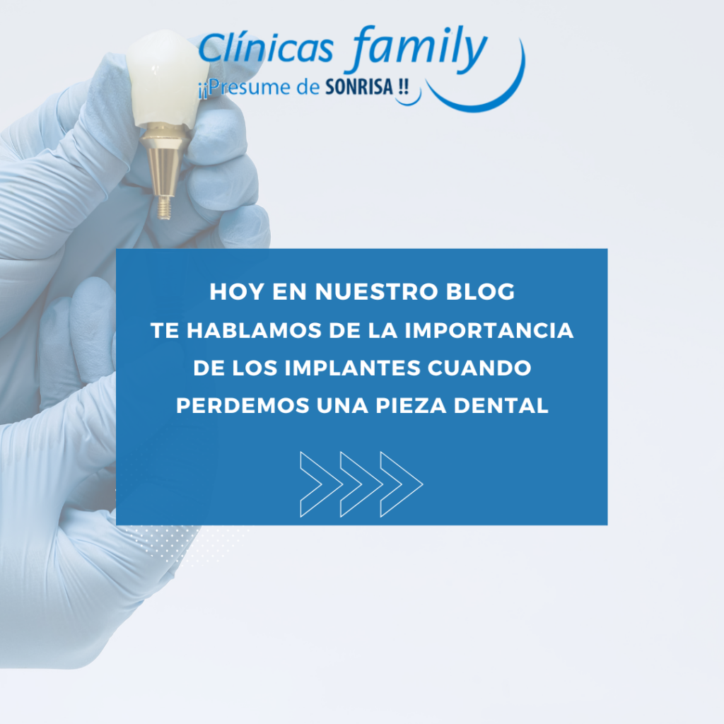 La importancia de los implantes cuando perdemos una pieza dental ...